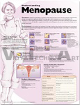 Understanding Menopause Anatomical Chart, 3rd Edition